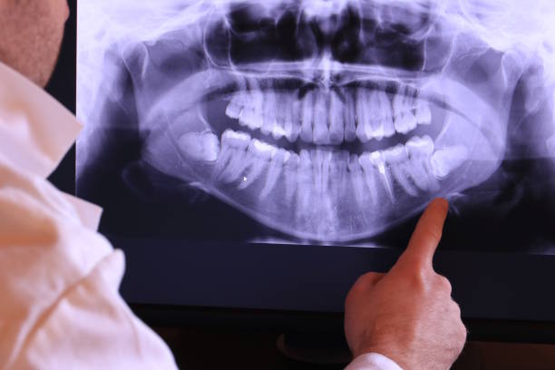 Best Emergency Wisdom Teeth Removal in Emigsville, PA