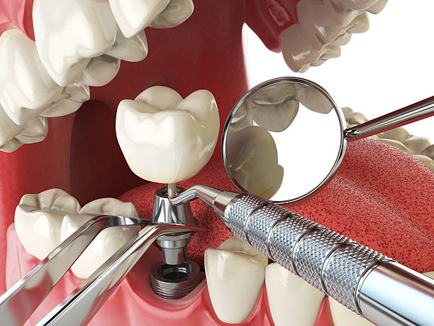 Best Emergency Broken Tooth Repair in Emigsville, PA